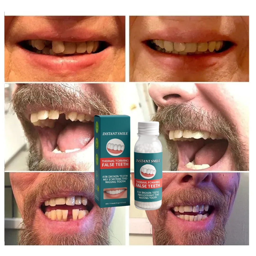 DentiFix™ - Dientes Postizos Temporales